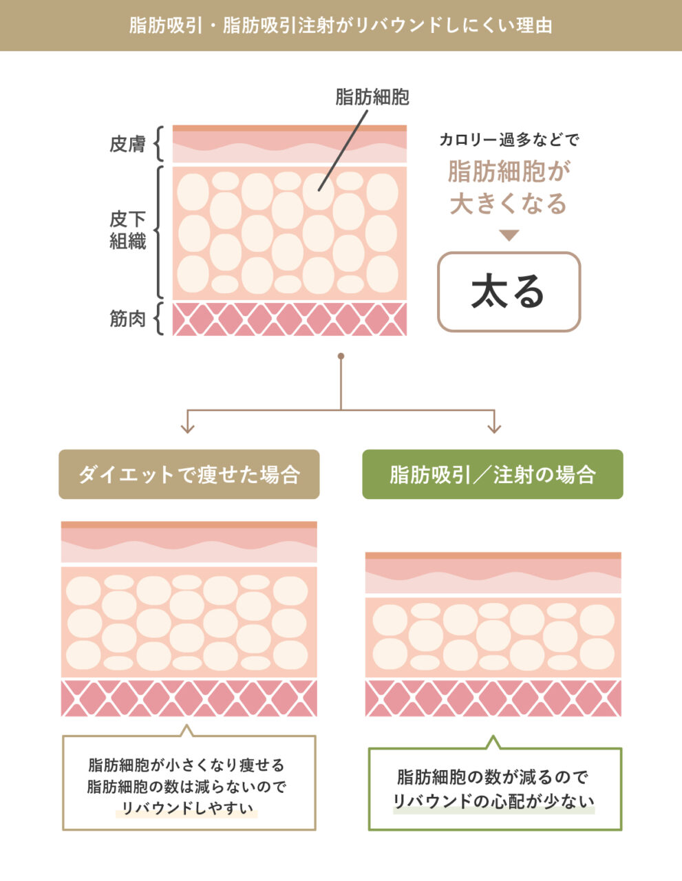 脂肪吸引のメリット