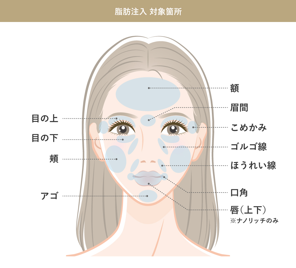 脂肪注入 対象箇所