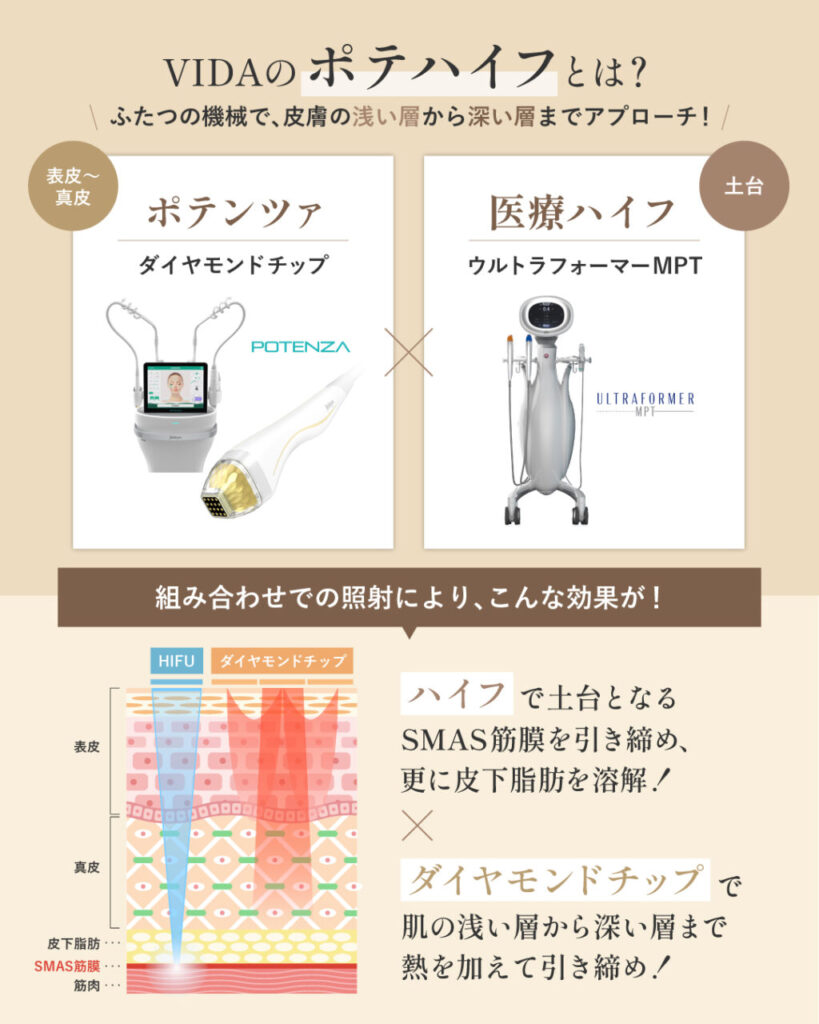 ポテハイフについて