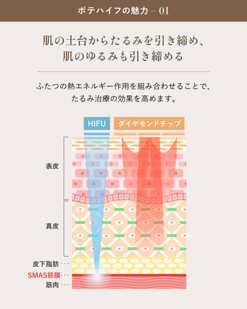 ポテハイフが人気の理由